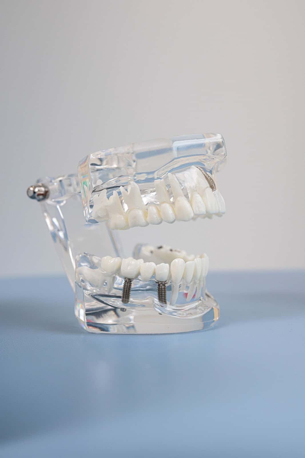 SPASOV DENTAL | Д-р Самуил Спасов
